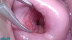 Japanese Wife Open Cervix Wide to watch inside Uterus Thumb